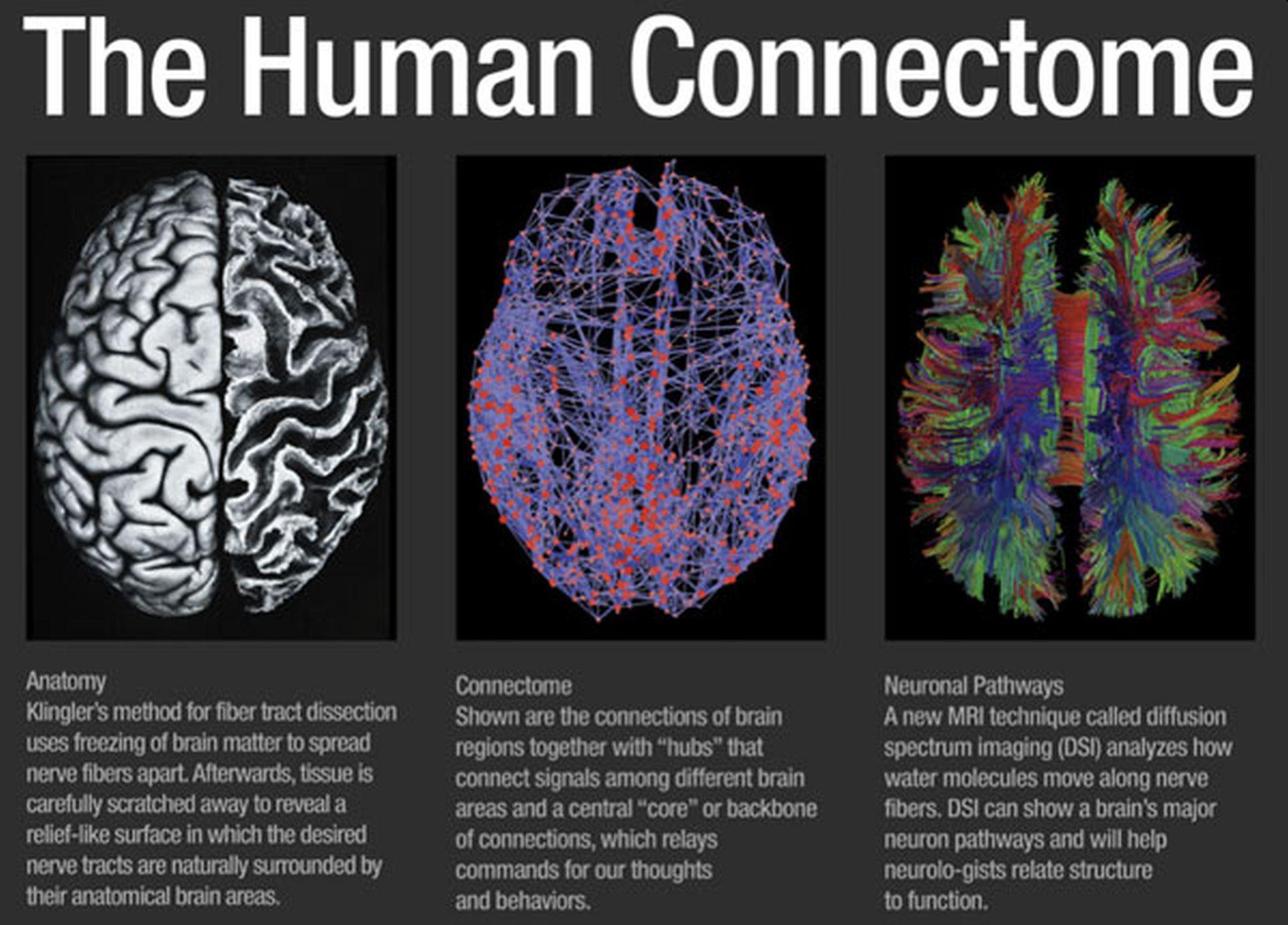 He is a brain. Коннектом мозга. Коннектом мозга человека это. Проект коннектом. Коннектом человека проект.